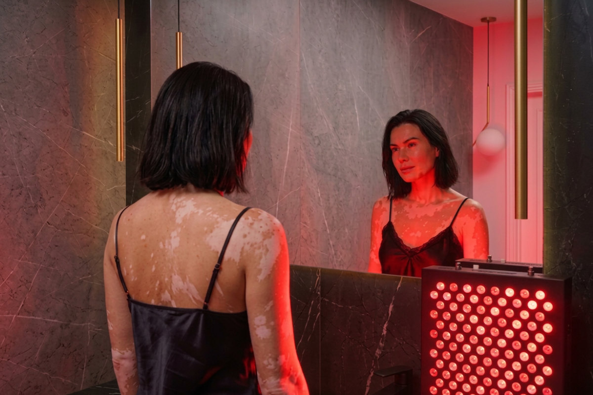 femeie cu vitiligo folosind panou cu lumina rosie acasa